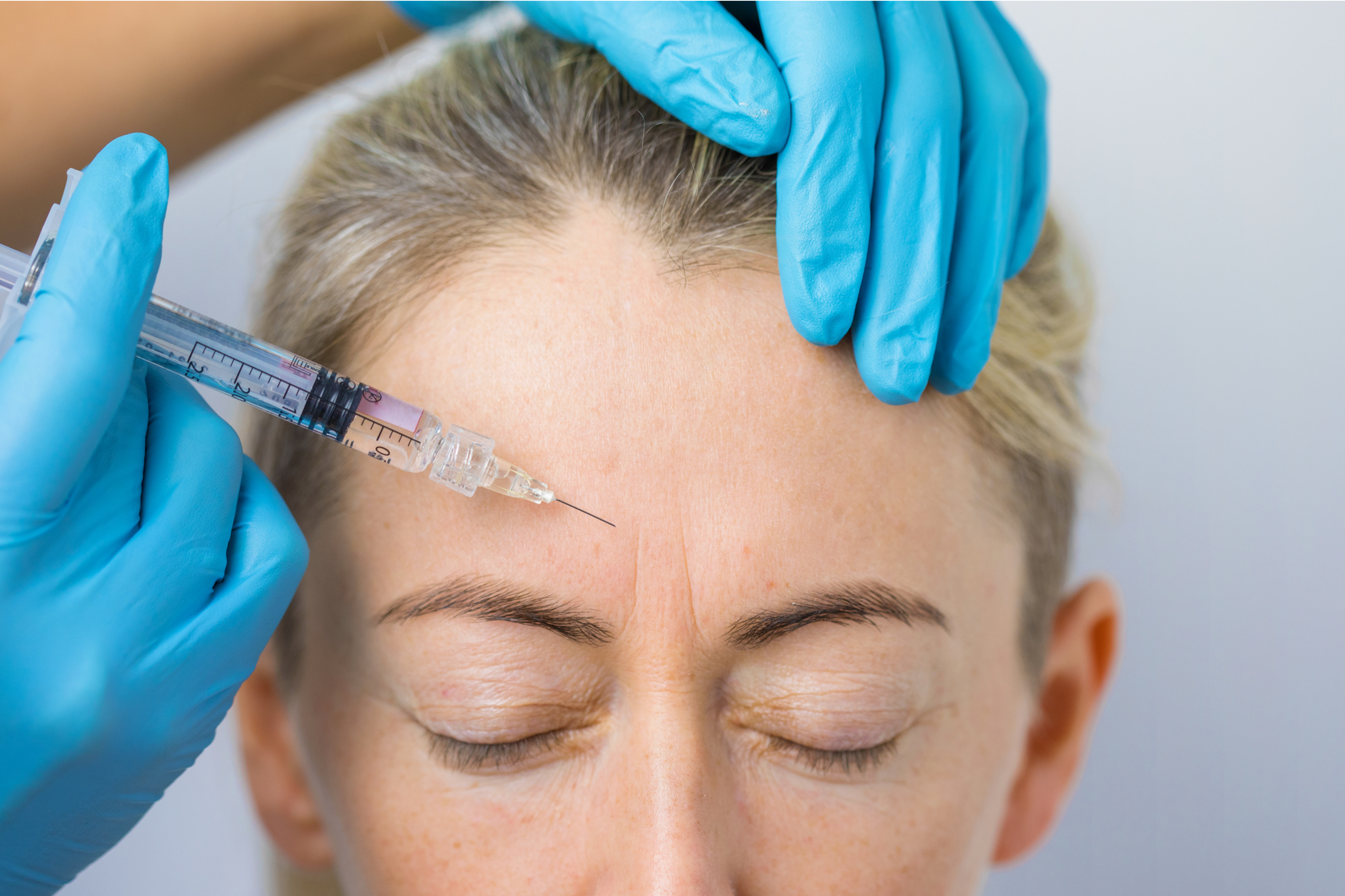 Botox treatment at HMS Fat Freezing Dubai