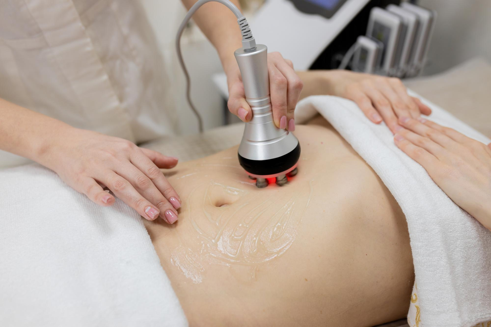 Cavitation treatment at HMS Fat Freezing Dubai