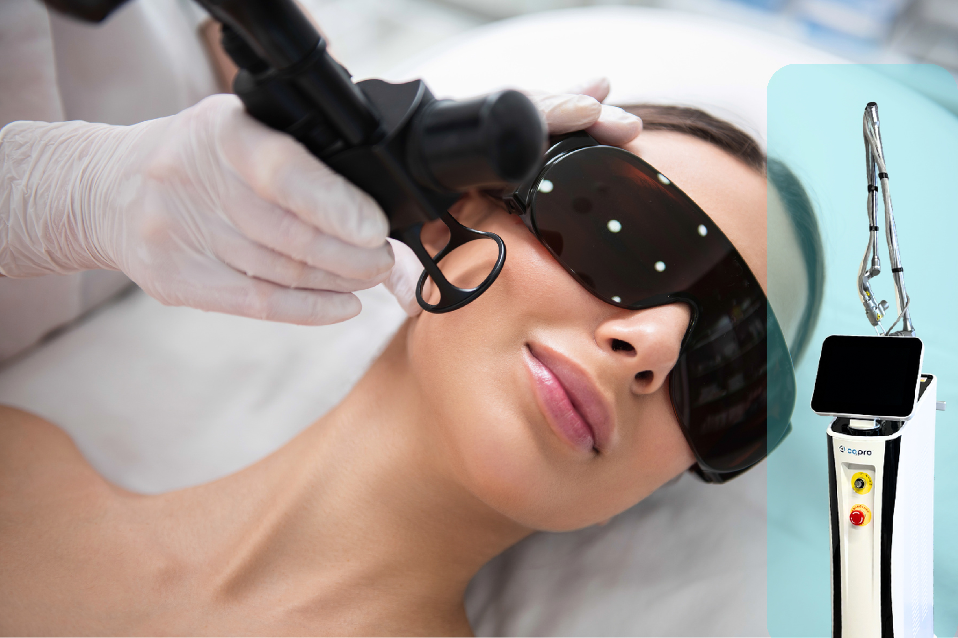 Fractional CO2 Laser Vaginal Tightening