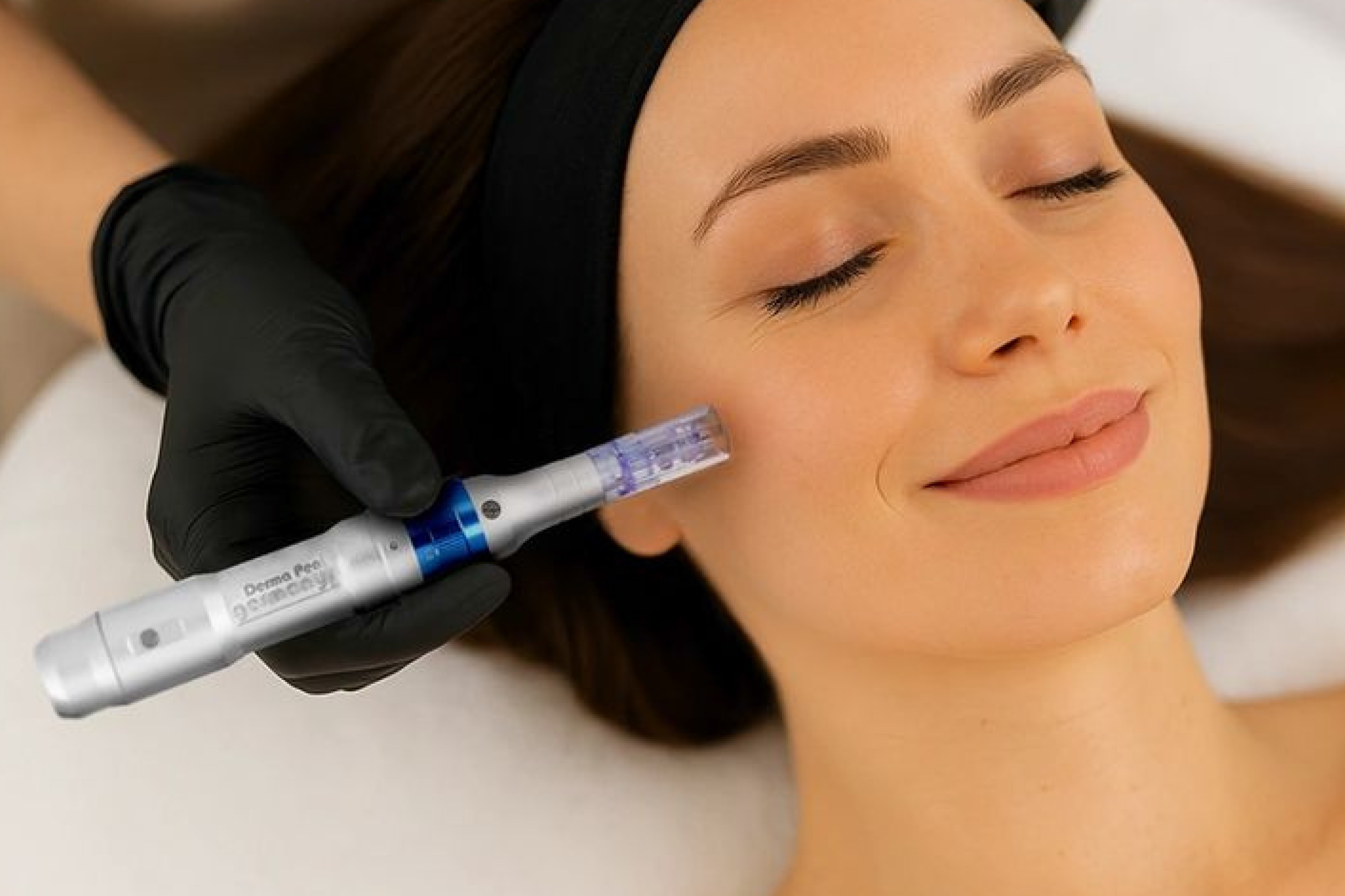PRP Face Rejuvenation Treatment